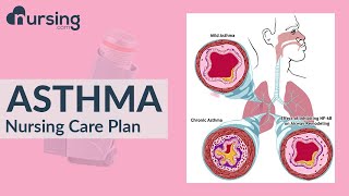 How to care for a patient with Asthma  Asthma Treatment  Nursing care plan [upl. by Maury]