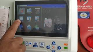 ELECTROCARDIOGRAFO CONTEC IMPRESION 6 CANALES como hago un electrocardiograma [upl. by Imas]