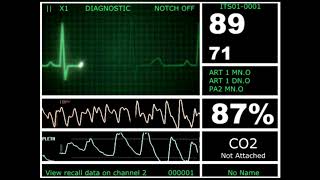 Hospital Monitor with FlatLine L HD [upl. by Stacie]