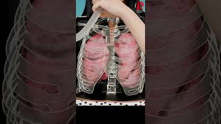 The Truth About Incentive Spirometry Doctor Explained [upl. by Tandy]