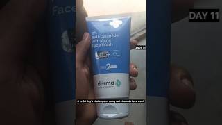 Day11 of using sali cinamide face wash  0 to 30 days challenge  shorts grooming challenge [upl. by Engelbert584]