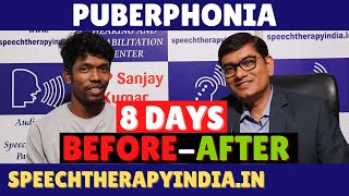 Unbelievable Voice Transformation in Just 8 Days  Puberphonia  SLPSanjayKumar  AIIMS Alumnus [upl. by Neumann27]