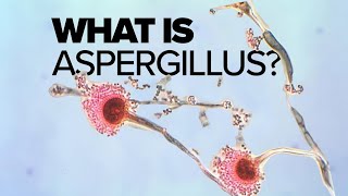 What is Aspergillus mold [upl. by Aivekal]