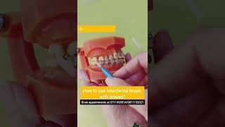 LIVE DEMO How to use interdental brush with braces Dr Srishti Bhatia braces [upl. by Dyann]