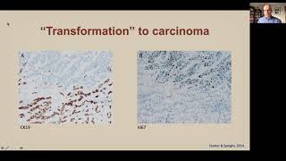 Odontogenic Cysts and Tumours diagnostic challenges Part 8 [upl. by Nnod]