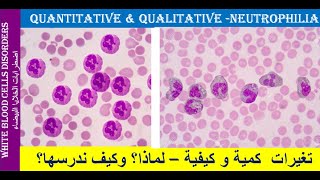 lecture 22 Neutrophilia Quantitative and Qualitative Changes [upl. by Attennaj261]