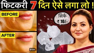 10 रूपए की चीज़ से Skin की सारी मुश्किल आसान  Facial Hair झाइयाँ Hyperpigmentation Wrinkles amp More💕 [upl. by Andrews]