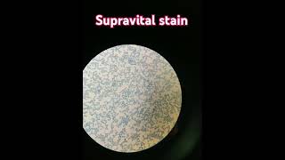 Supra vital stain  For reticulocyte count 💕 [upl. by Va]