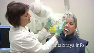 How to take dental xrays with bisecting angle positioning [upl. by Snehpets603]