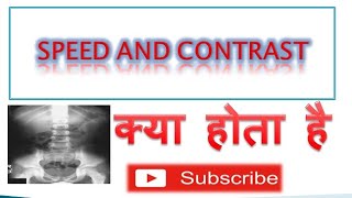 Radiographic Film Speed and Contrast CharacteristicCurve क्या होता है।😱 [upl. by Rusty]