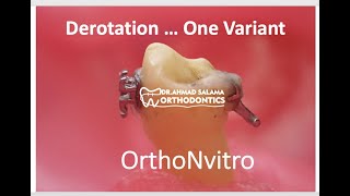 ep13 OrthoNvitro 1  derotation one variant [upl. by Jestude513]