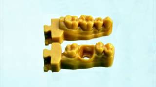 video modello con moncone sfilabile dentale stampante 3d odontotecnico [upl. by Zerimar]