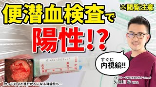 便潜血検査で陽性になったらどうすれば良いですか？ 教えて久津川先生 No69 [upl. by Meta]