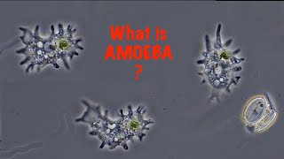 What is Amoeba [upl. by Ahk770]