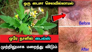 ஒரு பைசா செலவில்லாமல் ஒரே நாளில் பைல்ஸ் முற்றிலுமாக மறைந்து விடும்  Piles Treatment in Tamil Piles [upl. by Hceicjow]