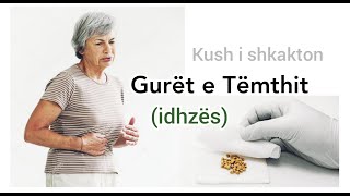 GURET NE TEMTH idhëz  Ushqimet qe nuk lejohen  Si sherohen guret e temthit  idhzes  Biliare [upl. by Alyled754]