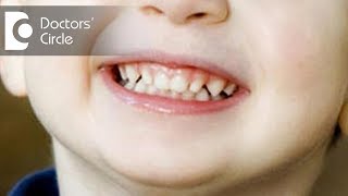 How can I help my child stop grinding his teeth  Dr Srivats Bharadwaj [upl. by Bently]