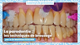 🦷 La parodontie  les différentes techniques de brossage avec le Dr Matthias RZEZNIK [upl. by Manheim]