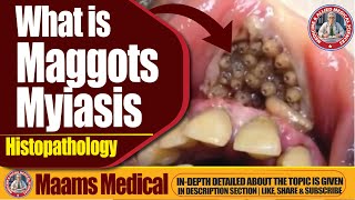 What is Maggots Myiasis Histopathology  Causes Symptoms and Treatment [upl. by Elliott]