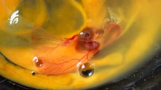 Chicken Egg Embryo  Not for the faint hearted [upl. by Ailaham]