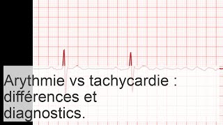 Comment larythmie et la tachycardie diffèrentelles  caractéristiques de lévolution des maladies [upl. by Aicilaf]