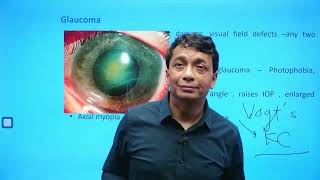 Ophthalmology  Rapid Revision  Part 2  Target FMGE 2024  Dr Saswat Ray720PHD [upl. by Ennaecarg]