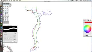 Meningeal AdhesionsRelease Explanation [upl. by Ahsiemal]