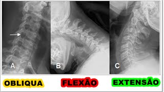 2Coluna Cervical  Oblíquas Flexão e Extensão [upl. by Pascoe]