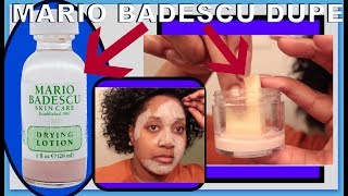 Mario Badescu Drying Lotion DUPE  How To Dry Out Pimples Fast AF [upl. by Tor620]