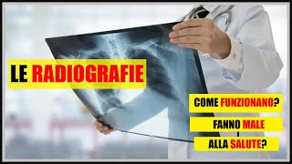 Cosa sono e come funzionano le radiografie Fanno male alla salute [upl. by Joice]