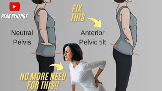 Fix Your Anterior Pelvic Tilt in 10 Minutes [upl. by Tertia]