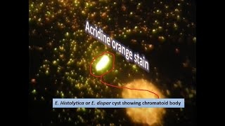 Acidine orange stained slide of chromatoid body of E histolytica or dispar [upl. by Awahsoj]