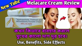 Melacare Cream Review  Melacare Cream use  Melacare Cream Benefits And Side Effects In Bangla [upl. by Anairb534]