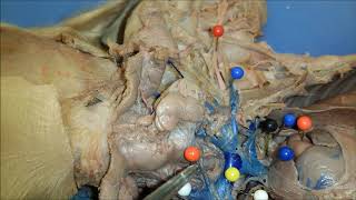 Fetal Pig Cardiovascular System Dissection for AampP lab [upl. by Akamahs541]