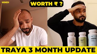 ✅ Traya Hair Regrowth👩‍🦲3 Month Progress Update 👉 My Honest Opinion 🟡 from hair loss to Thicker Hair [upl. by Guod235]