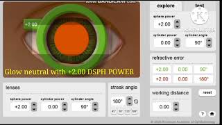 Retinoscopy Simulator online practice for optometrist [upl. by Alikahs]