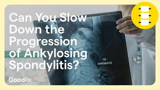 Ways To Prevent Anklylosing Spondylitis Progression  GoodRx [upl. by Neelrak]