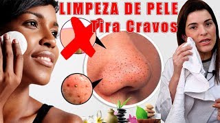 A Melhor LIMPEZA de PELE em Casa  Remove Cravos e deixa a Pele Maravilhosa [upl. by Adaliah]