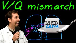 Ventilation Perfusion VQ Mismatch Explained Clearly [upl. by Thomasina218]