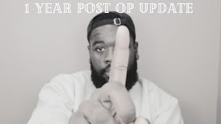 1 YEAR POSTOP BARIATRIC UPDATE WHAT I WEIGH NOW LOOSE SKIN UPDATE DO I REGRET GETTING SURGERY [upl. by Golub]