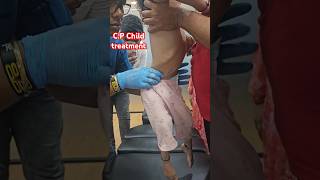 CP Child treatment drrajneeshkant chiropractor worldfamouschiropractor [upl. by Dilaw809]