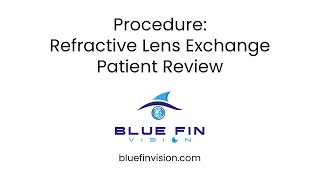 Refractive Lens Exchange Patient Review  5 [upl. by Ytsur17]