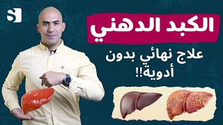 الكبد الدهني  علاج الكبد الدهني بدون ادويه  شفاء الكبد الدهني تماما [upl. by Ecinnaj]