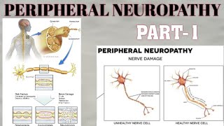 PERIPHERAL NEUROPATHY  PART1  WALLERIAN DISTAL AXONAL DEGENERATION amp SEGMENTAL DEMYELINATION [upl. by Ban103]