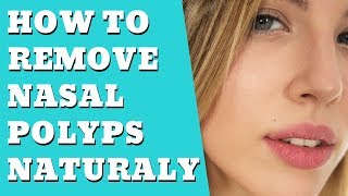 What Are Nasal Polyps  How to remove Nasal Polyps Naturally [upl. by Alvina889]