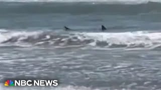 Texas shark attack survivor speaks out [upl. by Sire494]