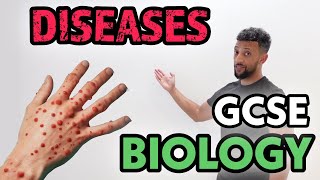 GCSE Biology  Infectious Diseases Rap [upl. by Moe942]