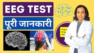 What is EEG Scan  Test Result and Interpretation in Hindi  Detect Epilepsy amp Seizure Disorders [upl. by Cida94]