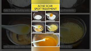 Home Remedies For Acne And Pimples ❤️❣️skincare acnetreatment shortvideo [upl. by Barde]