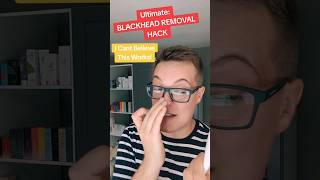 Ultimate BLACKHEAD REMOVAL HACK  Blackhead Plucking shorts [upl. by Attenahs]